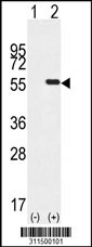 Western blot analysis of his-tag PPP2R2B (arrow) using his tag antibody. 293 cell lysates (2 ug/lane) either nontransfected (Lane 1) or transiently transfected with the PPP2R2B gene