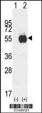 Western blot analysis of his-tag PDPK1 (arrow) using his tag antibody. 293 cell lysates (2 ug/lane) either nontransfected (Lane 1) or transiently transfected with the PDPK1 gene
