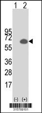 Western blot analysis of his-tag ZC3H15 (arrow) using his tag antibody. 293T cell lysates (2 ug/lane) either nontransfected (Lane 1) or transiently transfected with the ZC3H15 gene‘