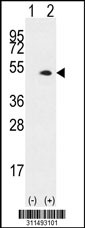 Western blot analysis of his-tag GLA (arrow) using his tag antibody. 293 cell lysates (2 ug/lane) either nontransfected (Lane 1) or transiently transfected with the GLA gene