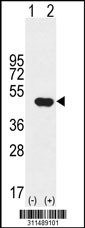 Western blot analysis of his-tag EMILIN1 (arrow) using his tag antibody. 293 cell lysates (2 ug/lane) either nontransfected (Lane 1) or transiently transfected with the EMILIN1 gene