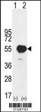 Western blot analysis of his-tag DOK2 (arrow) using his tag antibody. 293 cell lysates (2 ug/lane) either nontransfected (Lane 1) or transiently transfected with the DOK2 gene
