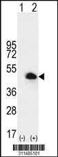 Western blot analysis of his-tag CSNK1E (arrow) using his tag antibody. 293 cell lysates (2 ug/lane) either nontransfected (Lane 1) or transiently transfected with the CSNK1E gene