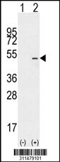 Western blot analysis of his-tag ACADM (arrow) using his tag antibody. 293 cell lysates (2 ug/lane) either nontransfected (Lane 1) or transiently transfected with the ACADM gene