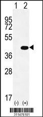 Western blot analysis of his-tag SMS (arrow) using his tag antibody. 293 cell lysates (2 ug/lane) either nontransfected (Lane 1) or transiently transfected with the SMS gene