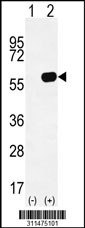 Western blot analysis of his-tag PRPH (arrow) using his tag antibody. 293 cell lysates (2 ug/lane) either nontransfected (Lane 1) or transiently transfected with the PRPH gene