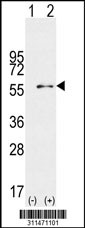 Western blot analysis of his-tag NCK1 (arrow) using his tag antibody. 293 cell lysates (2 ug/lane) either nontransfected (Lane 1) or transiently transfected with the NCK1 gene