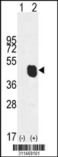 Western blot analysis of his-tag GJA1 (arrow) using his tag antibody. 293 cell lysates (2 ug/lane) either nontransfected (Lane 1) or transiently transfected with the GJA1 gene