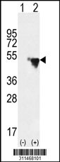 Western blot analysis of his-tag FOS (arrow) using his tag antibody. 293 cell lysates (2 ug/lane) either nontransfected (Lane 1) or transiently transfected with the FOS gene