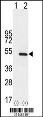 Western blot analysis of his-tag EIF4A1 (arrow) using his tag antibody. 293 cell lysates (2 ug/lane) either nontransfected (Lane 1) or transiently transfected with the EIF4A1 gene