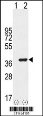 Western blot analysis of his-tag CDK4 (arrow) using his tag antibody. 293 cell lysates (2 ug/lane) either nontransfected (Lane 1) or transiently transfected with the CDK4 gene