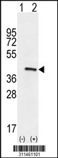 Western blot analysis of his-tag ART3 (arrow) using his tag antibody. 293 cell lysates (2 ug/lane) either nontransfected (Lane 1) or transiently transfected with the ART3 gene