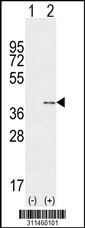 Western blot analysis of his-tag ADRBK2 (arrow) using his tag antibody. 293 cell lysates (2 ug/lane) either nontransfected (Lane 1) or transiently transfected with the ADRBK2 gene