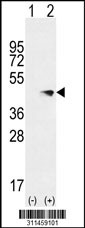 Western blot analysis of his-tag ACPP (arrow) using his tag antibody. 293 cell lysates (2 ug/lane) either nontransfected (Lane 1) or transiently transfected with the ACPP gene