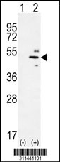 Western blot analysis of his-tag DKK3 (arrow) using his tag antibody. 293 cell lysates (2 ug/lane) either nontransfected (Lane 1) or transiently transfected with the DKK3 gene