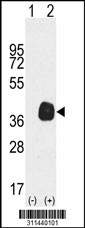 Western blot analysis of his-tag DCX (arrow) using his tag antibody. 293 cell lysates (2 ug/lane) either nontransfected (Lane 1) or transiently transfected with the DCX gene