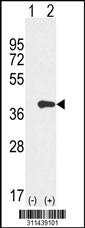 Western blot analysis of his-tag CRK (arrow) using his tag antibody. 293 cell lysates (2 ug/lane) either nontransfected (Lane 1) or transiently transfected with the CRK gene