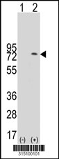 Western blot analysis of his-tag DGKA (arrow) using his tag antibody. 293T cell lysates (2 ug/lane) either nontransfected (Lane 1) or transiently transfected with the DGKA gene‘