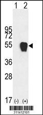 Western blot analysis of his-tag ZFP36 (arrow) using his tag antibody. 293 cell lysates (2 ug/lane) either nontransfected (Lane 1) or transiently transfected with the ZFP36 gene