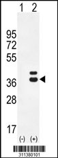 Western blot analysis of his-tag CA5B (arrow) using his tag antibody. 293 cell lysates (2 ug/lane) either nontransfected (Lane 1) or transiently transfected with the CA5B gene