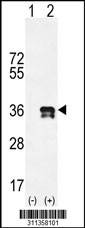 Western blot analysis of his-tag IL1B (arrow) using his tag antibody. 293 cell lysates (2 ug/lane) either nontransfected (Lane 1) or transiently transfected with the IL1B gene