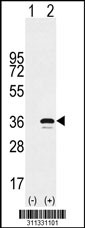 Western blot analysis of his-tag NT5E (arrow) using his tag antibody. 293 cell lysates (2 ug/lane) either nontransfected (Lane 1) or transiently transfected with the NT5E gene