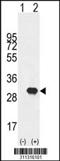 Western blot analysis of his-tag CA3 (arrow) using his tag antibody. 293 cell lysates (2 ug/lane) either nontransfected (Lane 1) or transiently transfected with the CA3 gene