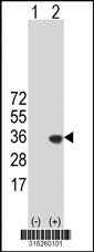 Western blot analysis of his-tag COPS7A (arrow) using his tag antibody. 293T cell lysates (2 ug/lane) either nontransfected (Lane 1) or transiently transfected with the COPS7A gene‘