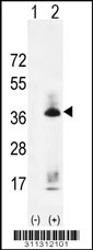 Western blot analysis of his-tag BNIP3L (arrow) using his tag antibody. 293 cell lysates (2 ug/lane) either nontransfected (Lane 1) or transiently transfected with the BNIP3L gene