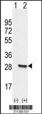 Western blot analysis of his-tag XTP3TPA (arrow) using his tag antibody. 293 cell lysates (2 ug/lane) either nontransfected (Lane 1) or transiently transfected with the XTP3TPA gene