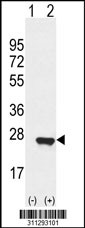 Western blot analysis of his-tag PEBP1 (arrow) using his tag antibody. 293 cell lysates (2 ug/lane) either nontransfected (Lane 1) or transiently transfected with the PEBP1 gene