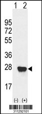 Western blot analysis of his-tag PARK7 (arrow) using his tag antibody. 293 cell lysates (2 ug/lane) either nontransfected (Lane 1) or transiently transfected with the PARK7 gene