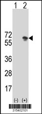 Western blot analysis of his-tag DPYSL5 (arrow) using his tag antibody. 293T cell lysates (2 ug/lane) either nontransfected (Lane 1) or transiently transfected with the DPYSL5 gene‘
