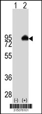 Western blot analysis of his-tag IL27RA (arrow) using his tag antibody. 293T cell lysates (2 ug/lane) either nontransfected (Lane 1) or transiently transfected with the IL27RA gene‘