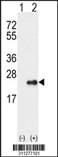 Western blot analysis of his-tag CAV2 (arrow) using his tag antibody. 293 cell lysates (2 ug/lane) either nontransfected (Lane 1) or transiently transfected with the CAV2 gene
