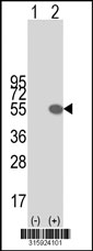 Western blot analysis of his-tag CRISPLD2 (arrow) using his tag antibody. 293T cell lysates (2 ug/lane) either nontransfected (Lane 1) or transiently transfected with the CRISPLD2 gene‘