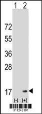 Western blot analysis of his-tag FABP4 (arrow) using his tag antibody. 293 cell lysates (2 ug/lane) either nontransfected (Lane 2) or transiently transfected with theFABP4 gene