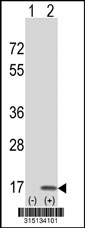 Western blot analysis of his-tag CRIP1 (arrow) using his tag antibody. 293T cell lysates (2 ug/lane) either nontransfected (Lane 1) or transiently transfected with the CRIP1 gene‘