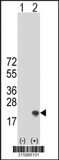 Western blot analysis of his-tag RBP2 (arrow) using his tag antibody. 293T cell lysates (2 ug/lane) either nontransfected (Lane 1) or transiently transfected with the RBP2 gene‘