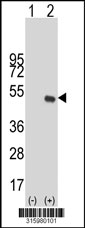 Western blot analysis of his-tag EFCAB4A (arrow) using his tag antibody. 293T cell lysates (2 ug/lane) either nontransfected (Lane 1) or transiently transfected with the EFCAB4A gene‘