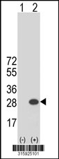 Western blot analysis of his-tag PPP1R14A (arrow) using his tag antibody. 293T cell lysates (2 ug/lane) either nontransfected (Lane 1) or transiently transfected with the PPP1R14A gene‘
