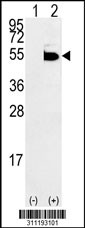 Western blot analysis of his-tag TGIF1 (arrow) using his tag antibody. 293 cell lysates (2 ug/lane) either nontransfected (Lane 1) or transiently transfected with the TGIF1 gene