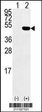 Western blot analysis of his-tag SERPINB2 (arrow) using his tag antibody. 293 cell lysates (2 ug/lane) either nontransfected (Lane 1) or transiently transfected with the SERPINB2 gene