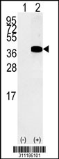 Western blot analysis of his-tag RTCD1 (arrow) using his tag antibody. 293 cell lysates (2 ug/lane) either nontransfected (Lane 1) or transiently transfected with the RTCD1 gene