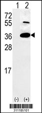 Western blot analysis of his-tag RCL1 (arrow) using his tag antibody. 293 cell lysates (2 ug/lane) either nontransfected (Lane 1) or transiently transfected with the RCL1 gene