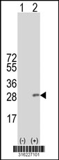 Western blot analysis of his-tag LY6K (arrow) using his tag antibody. 293T cell lysates (2 ug/lane) either nontransfected (Lane 1) or transiently transfected with the LY6K gene‘