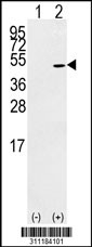 Western blot analysis of his-tag PTPN2 (arrow) using his tag antibody. 293 cell lysates (2 ug/lane) either nontransfected (Lane 1) or transiently transfected with the PTPN2 gene