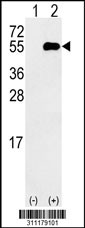 Western blot analysis of his-tag MAGEC2 (arrow) using his tag antibody. 293 cell lysates (2 ug/lane) either nontransfected (Lane 1) or transiently transfected with the MAGEC2 gene