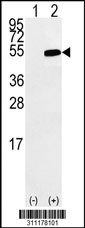Western blot analysis of his-tag JMJD5 (arrow) using his tag antibody. 293 cell lysates (2 ug/lane) either nontransfected (Lane 1) or transiently transfected with the JMJD5 gene