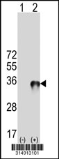 Western blot analysis of his-tag SH3GL1 (arrow) using his tag antibody. 293T cell lysates (2 ug/lane) either nontransfected (Lane 1) or transiently transfected with the SH3GL1 gene‘
